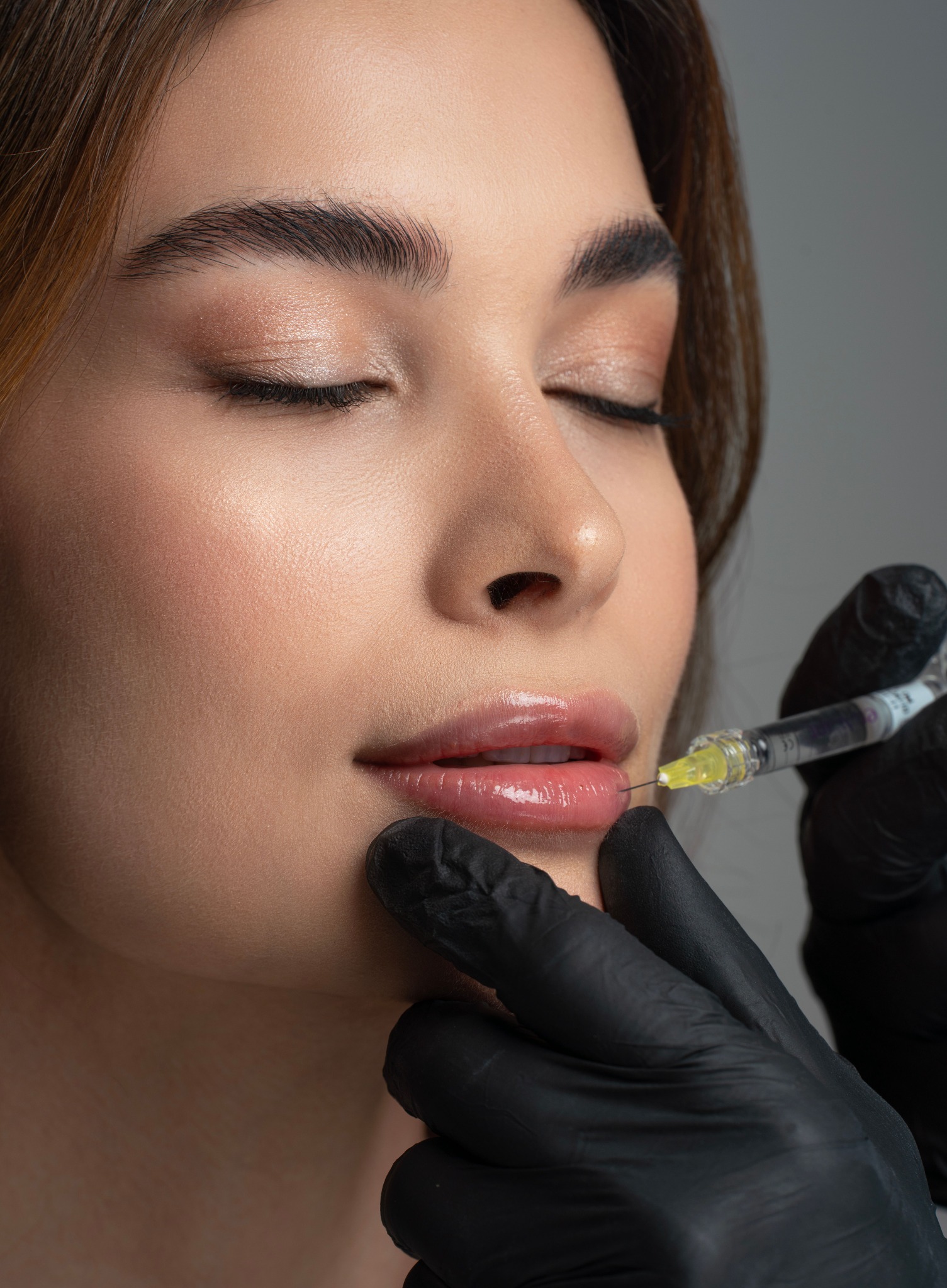 Procedimento estético de preenchimento labial